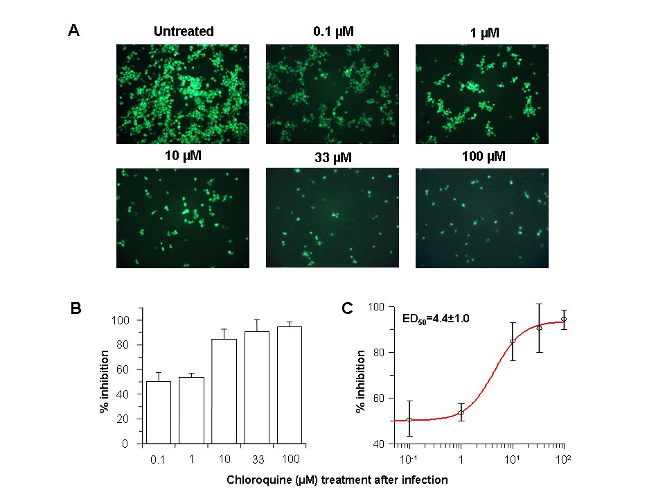 Chloroquine is a potent inhibitor of SARS coronavirus infection and spread