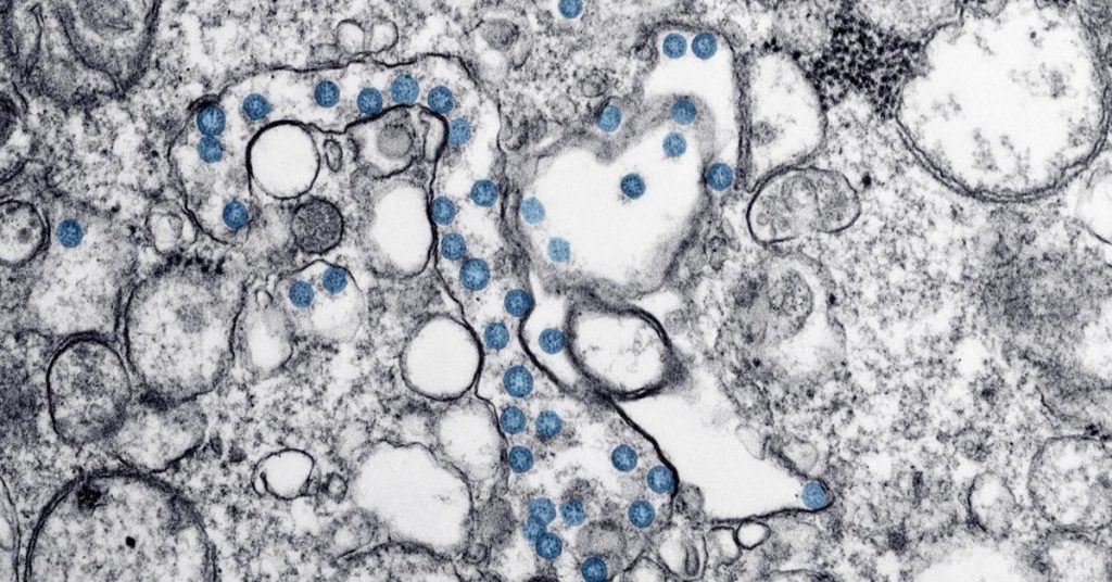 5 times the CDC got it wrong on coronavirus