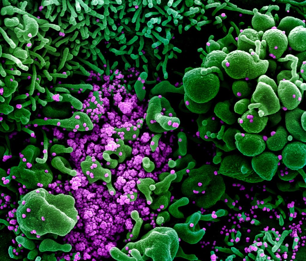 What is the secretive institute that found an antibody to the coronavirus?