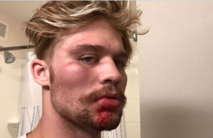 Antifa Terrorists Attack Independent Journalist in Portland — Beat Him Bloody