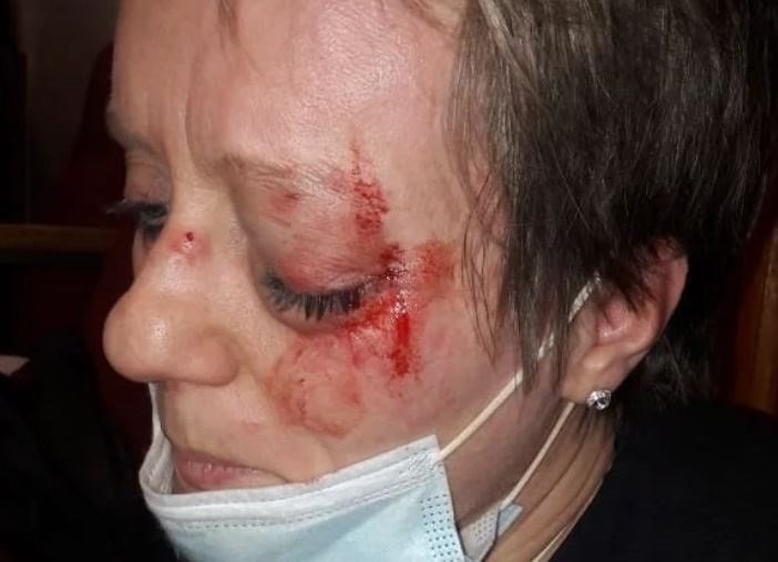 South Africa - Attorney allegedly assaulted in court room by accused appearing on assault charge