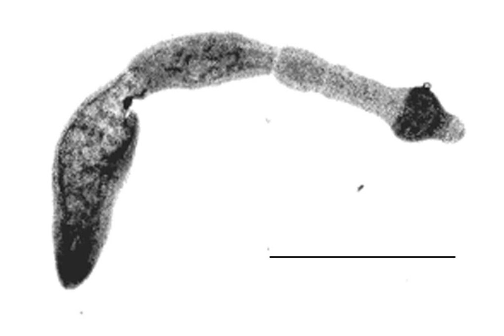 Cancer-like parasitic worm disease on the rise in Canada