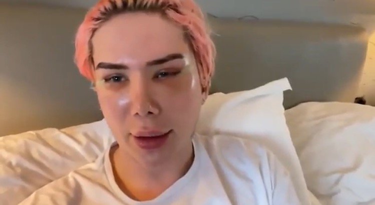 White British Guy Gets 18 Plastic Surgeries to Become Non-Binary Korean (VIDEO)
