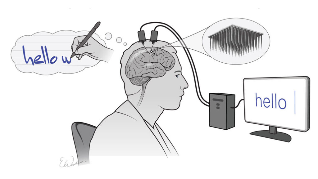 Brain implants turn imagined handwriting into text on a screen