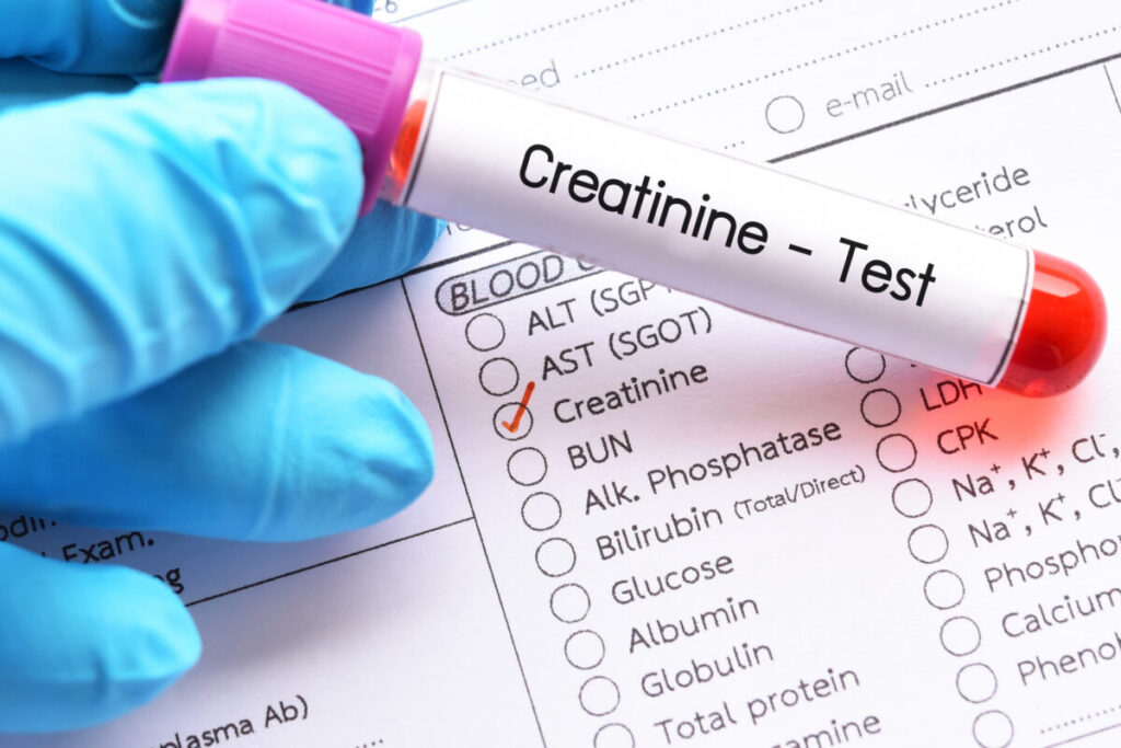 Covid Long-Haulers Face Higher Risk of Severe Kidney Disease