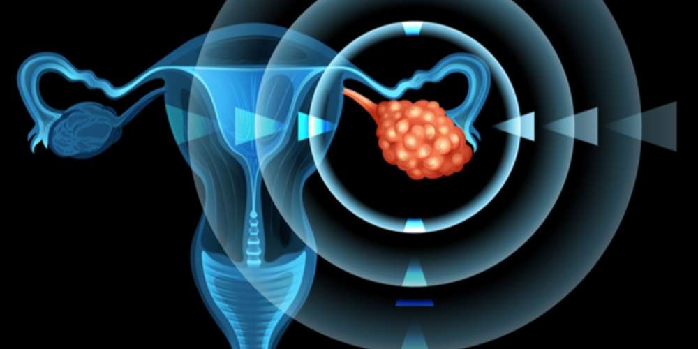 Pfizer Knew Its mRNA “Vaccine” for Covid “Leaked Into Ovaries” but Covered It All Up
