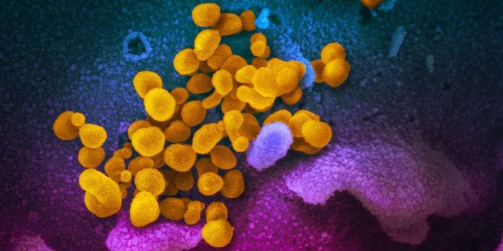 Micro-Clots from ‘Long Covid’ or Jabs: There’s a Solid Test for Them but Very Few Doctors Are Using It