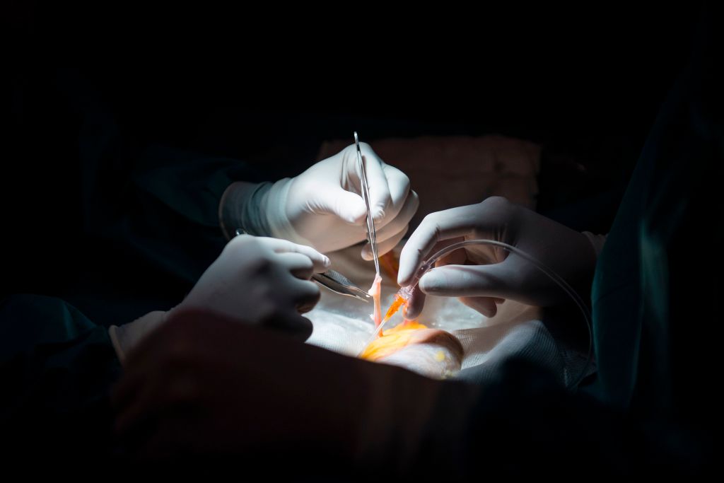 Surgeons as ‘Executioners’: Chinese Doctors Committed Murder to Fuel Regime’s Organ Transplant Industry, Study Finds