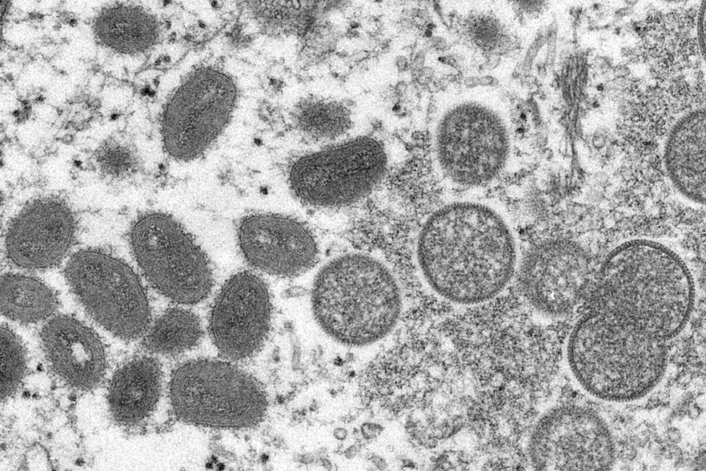 CDC Advises Doctors to Be on Alert for Monkeypox as WHO Confirms Outbreaks in 11 Countries