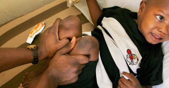 Mozambique: Polio Outbreak Causes Public Health Emergency