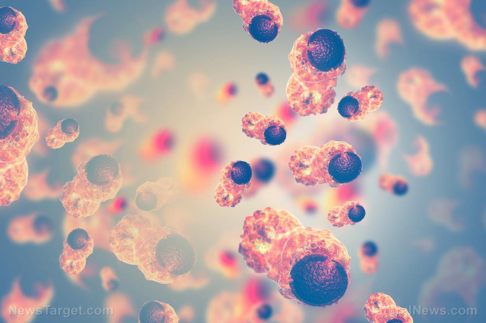 Idaho doctor warns about COVID-19 vaccines causing spike in cancer diagnoses