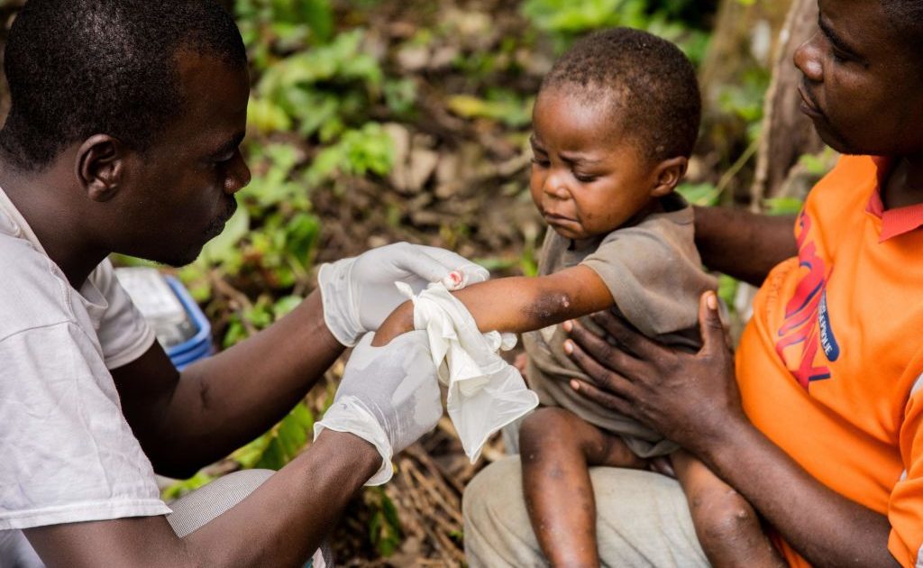 Experts Warn Biden’s Response To Monkeypox Is ‘Slow’