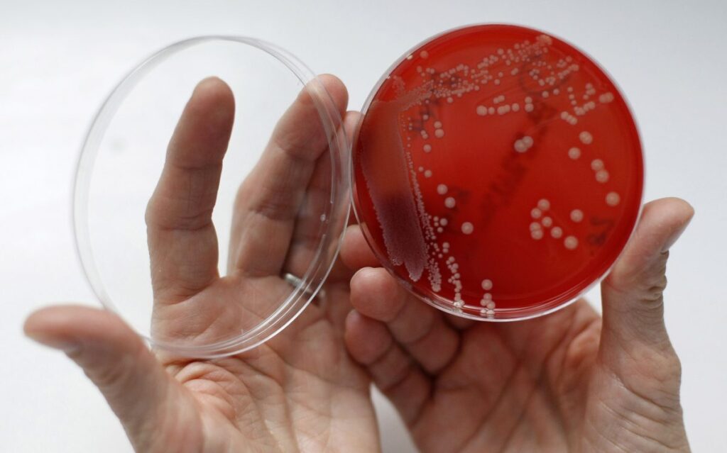 COVID-19 Pandemic Has Brought a Life-Threatening Infection Spike in Hospitals, Raising Serious Concerns