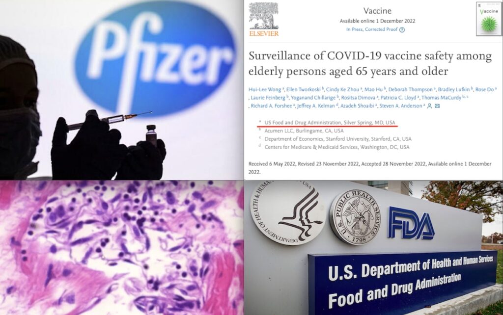 VITAL! Pfizer mRNA Vaccines: Risks of Pulmonary Embolism, Myocarditis, Blood Clots. FDA Disturbing Surveillance Data Finally Released