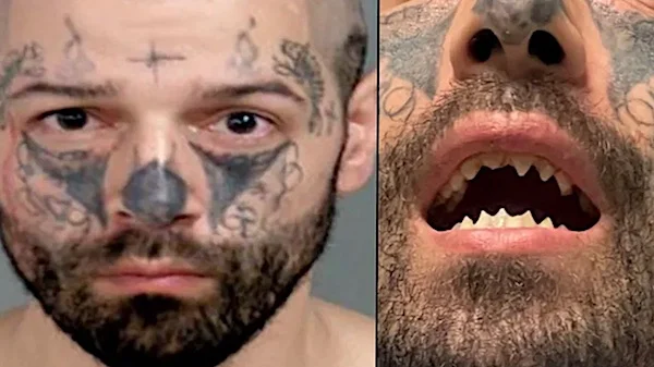 'A monster': Pregnant gal escapes house of horror of 'kidnapper' with razor-sharp teeth