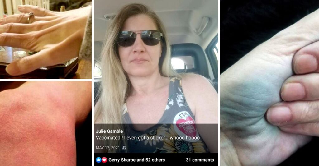 Exclusive: 53-Year-Old Woman Details Aftermath of COVID Vaccine Injury
