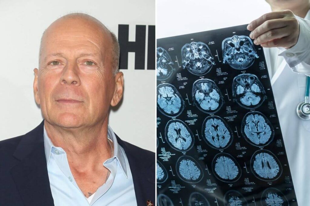 BREAKING: Bruce Willis Condition Update
