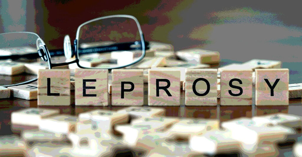 CDC Reports Uptick in Leprosy Cases in Florida, While U.K., India Researchers Link Leprosy Adverse Events to mRNA Vaccines