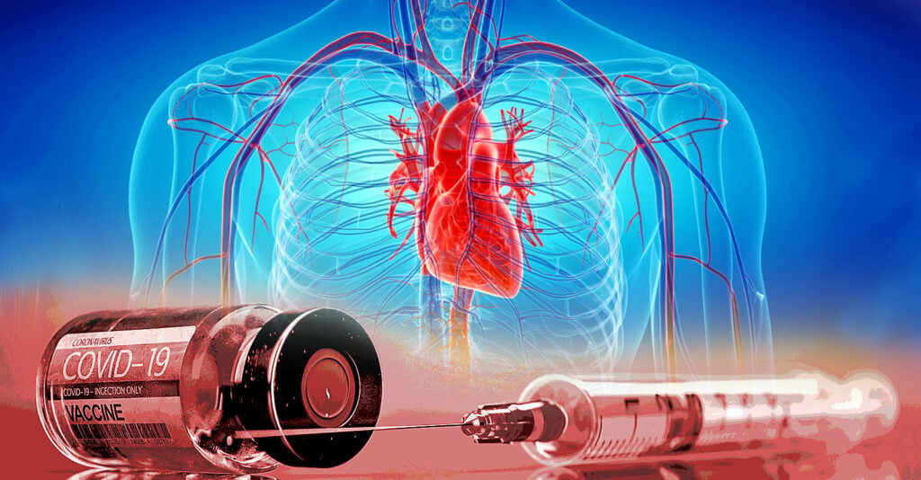 Lipid Nanoparticles in COVID Vaccines Travel to Vital Organs, Including Heart