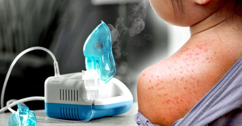 Texas Health Officials Reject Doctor’s Plea to Recommend Measles Treatment